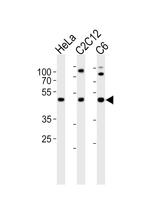 LIS1 Antibody in Western Blot (WB)