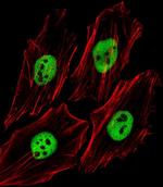 TRIM24 Antibody in Immunocytochemistry (ICC/IF)