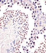 TRIM24 Antibody in Immunohistochemistry (IHC)
