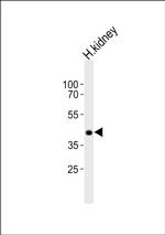 PCGF6 Antibody in Western Blot (WB)