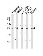 MIXL1 Polyclonal Antibody