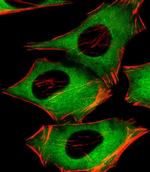 PIP4K2A Antibody in Immunocytochemistry (ICC/IF)
