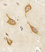 PIP4K2A Antibody in Immunohistochemistry (IHC)