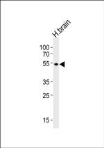 PIP4K2A Antibody in Western Blot (WB)