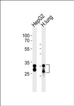 SULT1A1 Antibody in Western Blot (WB)