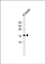 LC3A Antibody in Western Blot (WB)