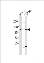 CHSY3 Antibody in Western Blot (WB)