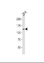 SH3BP4A Polyclonal Antibody