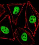 PDX1 Antibody in Immunocytochemistry (ICC/IF)