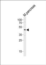 PDX1 Antibody in Western Blot (WB)