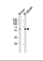 SRMS Antibody in Western Blot (WB)