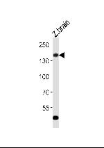 GPR126 Antibody in Western Blot (WB)