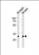 HOXB1 Antibody in Western Blot (WB)