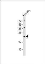 FAM168B Antibody in Western Blot (WB)