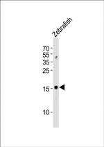 GABARAPL2 Antibody in Western Blot (WB)