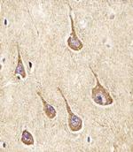 NPY2R Polyclonal Antibody