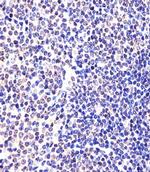 EED Antibody in Immunohistochemistry (IHC)