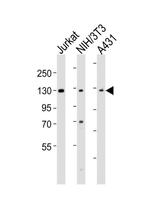 hnRNP U Antibody in Western Blot (WB)