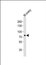 MELK Antibody in Western Blot (WB)