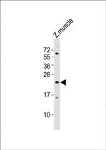 TMEM208 Polyclonal Antibody