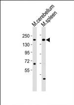 KDM6A Antibody in Western Blot (WB)