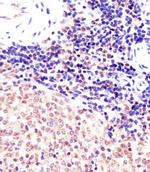 SUZ12 Antibody in Immunohistochemistry (IHC)