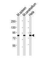 SUZ12 Antibody in Western Blot (WB)