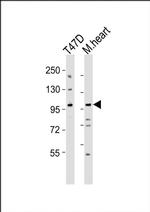 CLEC16A Antibody in Western Blot (WB)