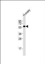 DRD5 Antibody in Western Blot (WB)
