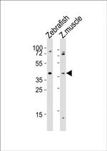 APLNRA Polyclonal Antibody