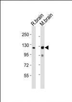 NLGN3 Antibody in Western Blot (WB)