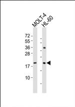 RAC2 Antibody in Western Blot (WB)