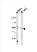 Calpain 5 Antibody in Western Blot (WB)