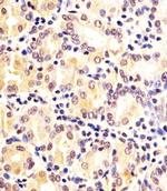 FN3KRP Antibody in Immunohistochemistry (IHC)