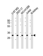 FN3KRP Antibody in Western Blot (WB)