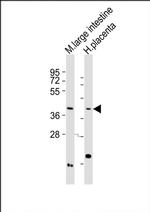 MC3R Antibody in Western Blot (WB)