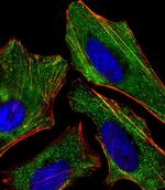 KISS1 Antibody in Immunocytochemistry (ICC/IF)