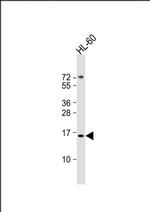 KISS1 Antibody in Western Blot (WB)