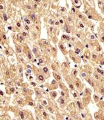 PGM1 Antibody in Immunohistochemistry (IHC)