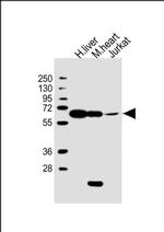 PGM1 Antibody in Western Blot (WB)