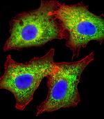 AKR7L Polyclonal Antibody