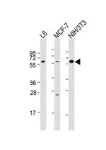 YES1 Antibody in Western Blot (WB)