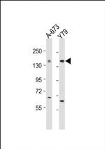 CACNA1F Antibody in Western Blot (WB)