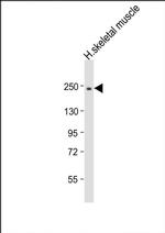MYH2 Antibody in Western Blot (WB)