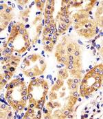 HTR1E Antibody in Immunohistochemistry (IHC)
