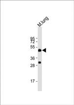 DPEP2 Antibody in Western Blot (WB)