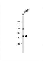 ADAM21 Polyclonal Antibody