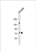 FLYWCH1 Polyclonal Antibody