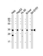 ADORA3 Antibody in Western Blot (WB)