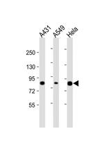PLA2G4D Polyclonal Antibody